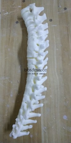 医疗 手术前模型 骨头科 模型