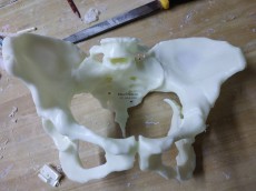 医疗 手术前模型 骨头模型